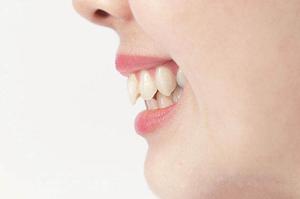 和歌山市で理想の歯並びを手に入れる！インビザライン治療の全貌と費用ガイド