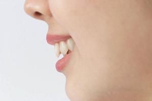 表参道で最先端のボトックス治療を叶える2026年完全ガイド